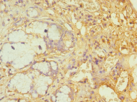 Polyclonal Rabbit anti-Human ATXN1 / SCA1 Antibody (aa586-815, IHC)