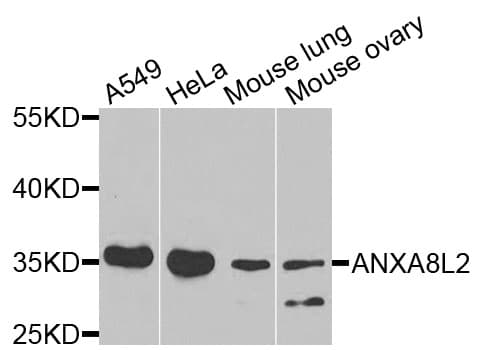 ANXA8L1 Antibody