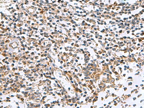 Polyclonal Rabbit anti-Human AP1S3 Antibody (IHC)