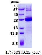 Human LSM12 Protein (Recombinant His)