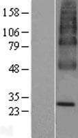 TERE1 / UBIAD1 Protein (Over-Expression Lysate Myc-DDK (Flag))
