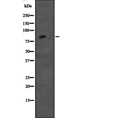 Polyclonal Rabbit anti-Human CDH12 / Cadherin 12 Antibody (WB)