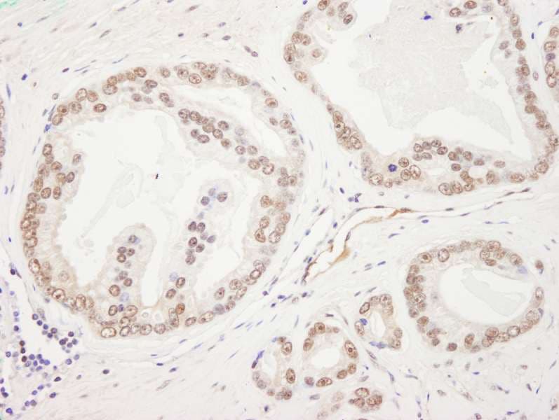 RAD50 Antibody (aa700-750)