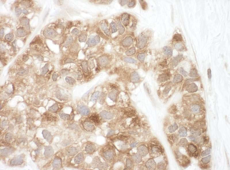 Polyclonal Rabbit anti-Human AIFM1 / AIF / PDCD8 Antibody (aa100-150, IHC, WB)