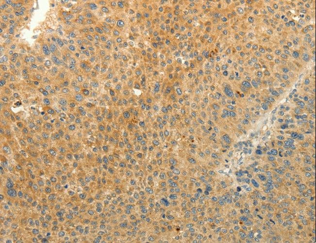 Polyclonal Rabbit anti-Human LPAR3 / LPA3 / EDG7 Antibody (IHC)