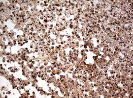 Monoclonal Mouse anti-Human NUMB Antibody (clone OTI2E8, aa1-365, IHC, WB)