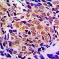 Histone Deacetylase HDAC5 / HDAC9 Antibody (Internal)