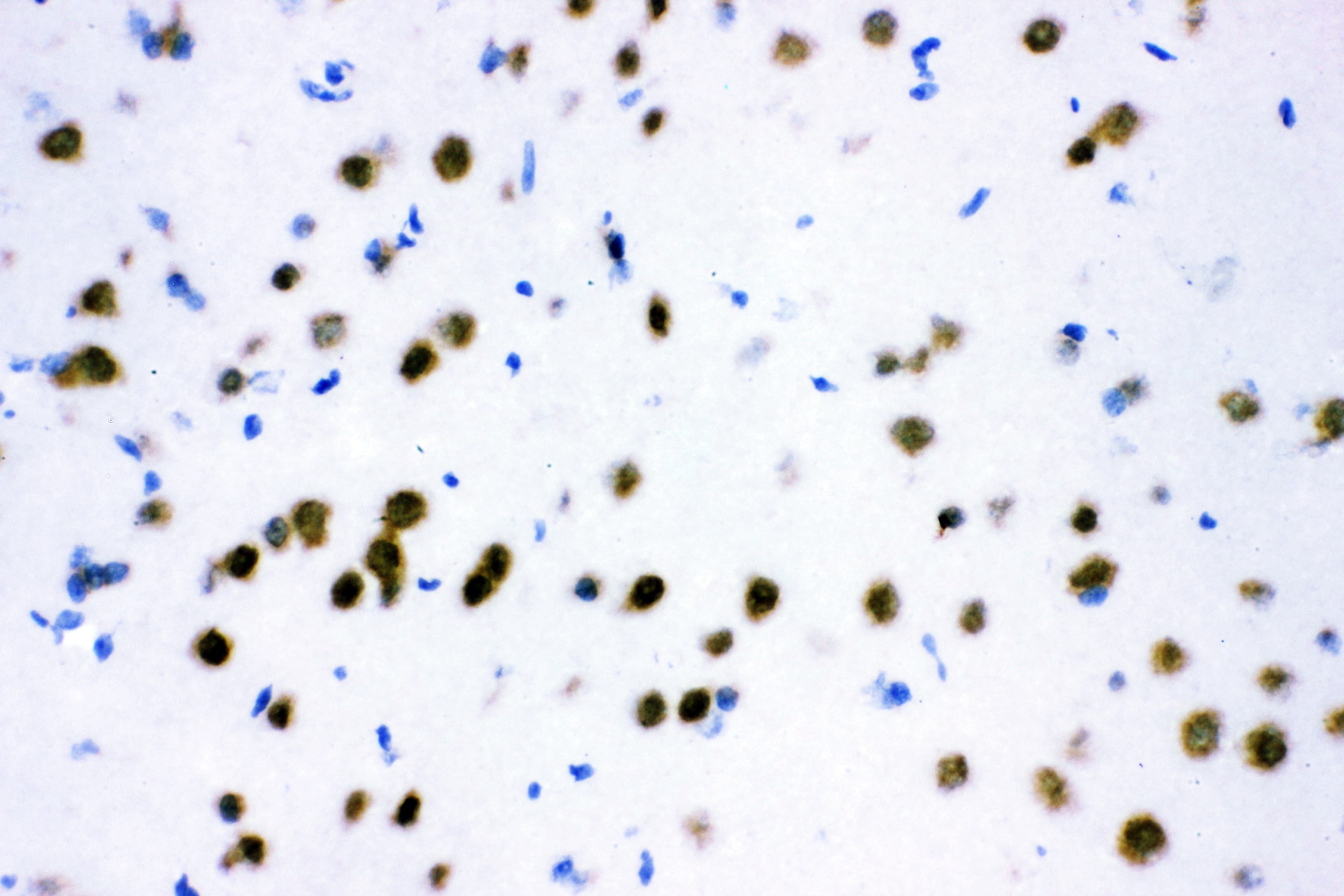 ATF2 Antibody (aa93-450)