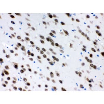 ELAVL4 / HuD Antibody (aa8-45)