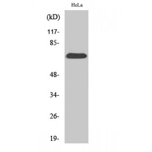 Polyclonal Rabbit anti-Human SDHA Antibody (C-terminal, WB)