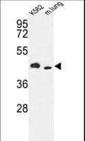 ITPKA Antibody (aa345-375)