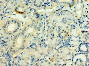 Polyclonal Rabbit anti-Human STXBP3 Antibody (aa343-592, IHC, WB)