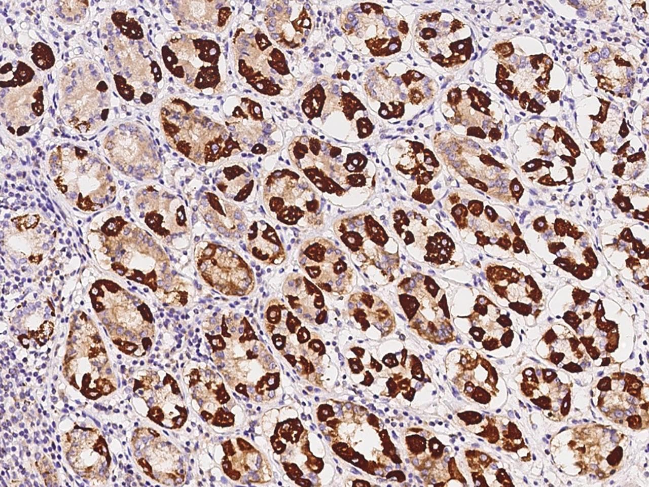 OXCT1 Antibody