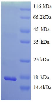 Rat NGF Protein (Recombinant His)