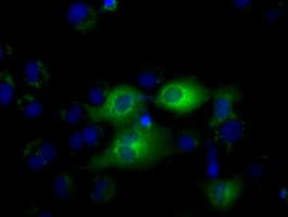 IFIT1 / ISG56 Antibody (clone OTI3G8)