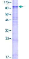 Human SLC1A2 / EAAT2 / GLT-1 Protein (Recombinant GST)