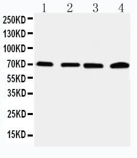 IRAK2 / IRAK-2 Antibody (aa600-616)