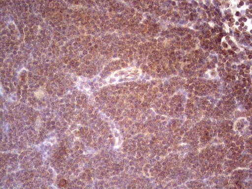 DMN / Desmuslin / Synemin Antibody (aa329-580, clone OTI7H6, Carrier-free)