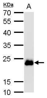 IHC-plus™ RAB6A / RAB6 Antibody (aa1-208)