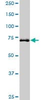 HHIP / HIP Antibody (clone 5D11)