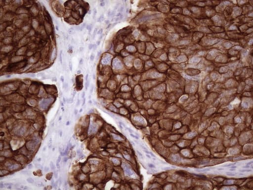 KRT16 / CK16 / Cytokeratin 16 Antibody (clone OTI1G5, Carrier-free)