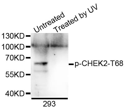 CHEK2 / CHK2 Antibody (phospho-Thr68)