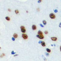 MED24 / TRAP100 Antibody (C-Terminus)