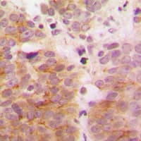 MAP3K7 / TAK1 Antibody (Internal)
