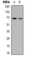 Polyclonal Rabbit anti-Human RHOBTB3 Antibody (Internal, WB)