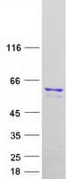 Human TRF1 / TERF1 Protein (Recombinant Myc-DDK (Flag))