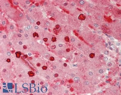 PYGL Antibody (Biotin)