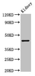 Polyclonal Rabbit anti-Human PRMT1 Antibody (IHC, WB)