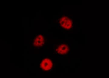 EIF2AK2 / PKR Antibody