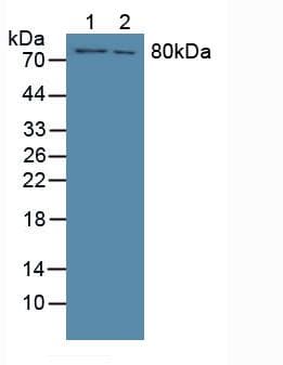 F13A1 / Factor XIIIa Antibody (aa107-345, APC)
