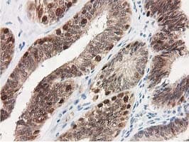 SMS / Spermine Synthase Antibody (clone OTI2G8)