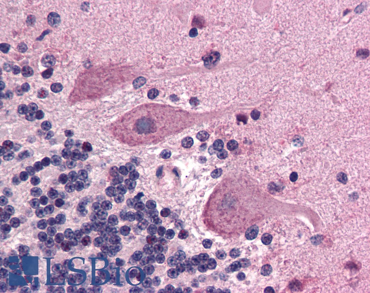 IHC-plus™ Polyclonal Rabbit anti-Human SCN1A / Nav1.1 Antibody (N-Terminus, IHC)