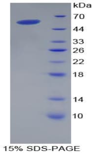 Mouse CD8A / CD8 Alpha Protein (Recombinant His-GST)