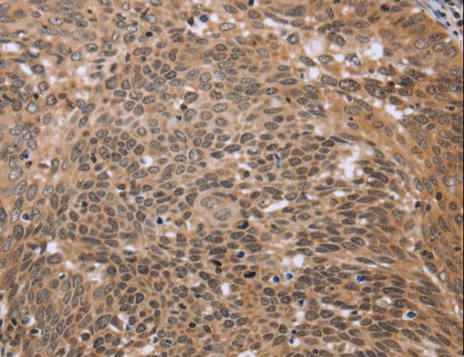 Polyclonal Rabbit anti-Human ERCC6L / FLJ20105 Antibody (IHC)