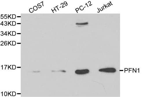 PFN1 / Profilin 1 Antibody