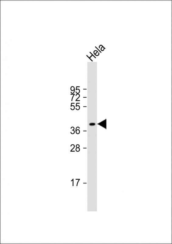 LPGAT1 Antibody (Internal)