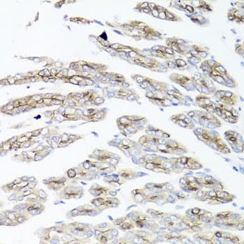 IER3 / IEX-1 Antibody