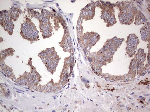 Monoclonal Mouse anti-Human PKM2 Antibody (clone 11B11, IHC, WB)