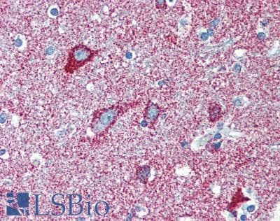IHC-plus™ CISD1 Antibody