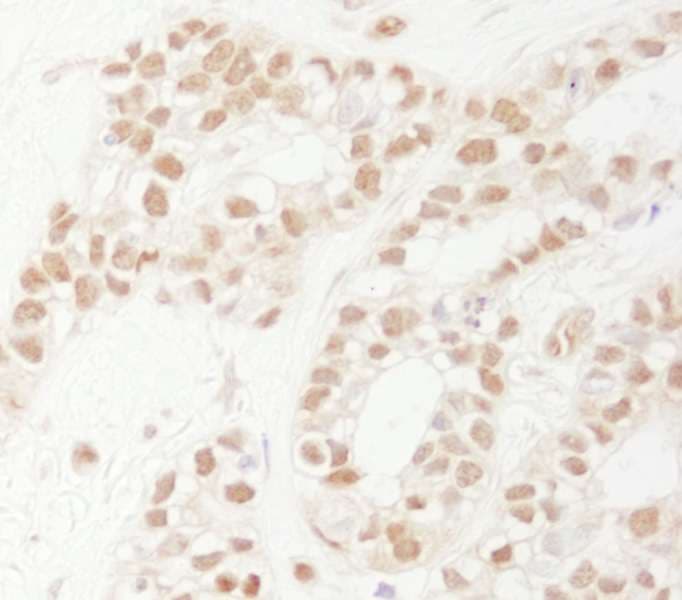 Polyclonal Rabbit anti-Human RAD9A / RAD9 Antibody (aa350-C-term, IHC, WB)