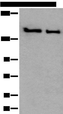 SMC1A / SMC1 Antibody