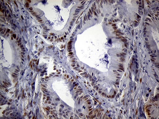 Monoclonal Mouse anti-Human SPANXB1 Antibody (clone OTI1E11, IHC, WB)
