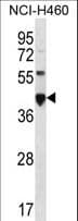 CEACAM18 Antibody (aa93-121)