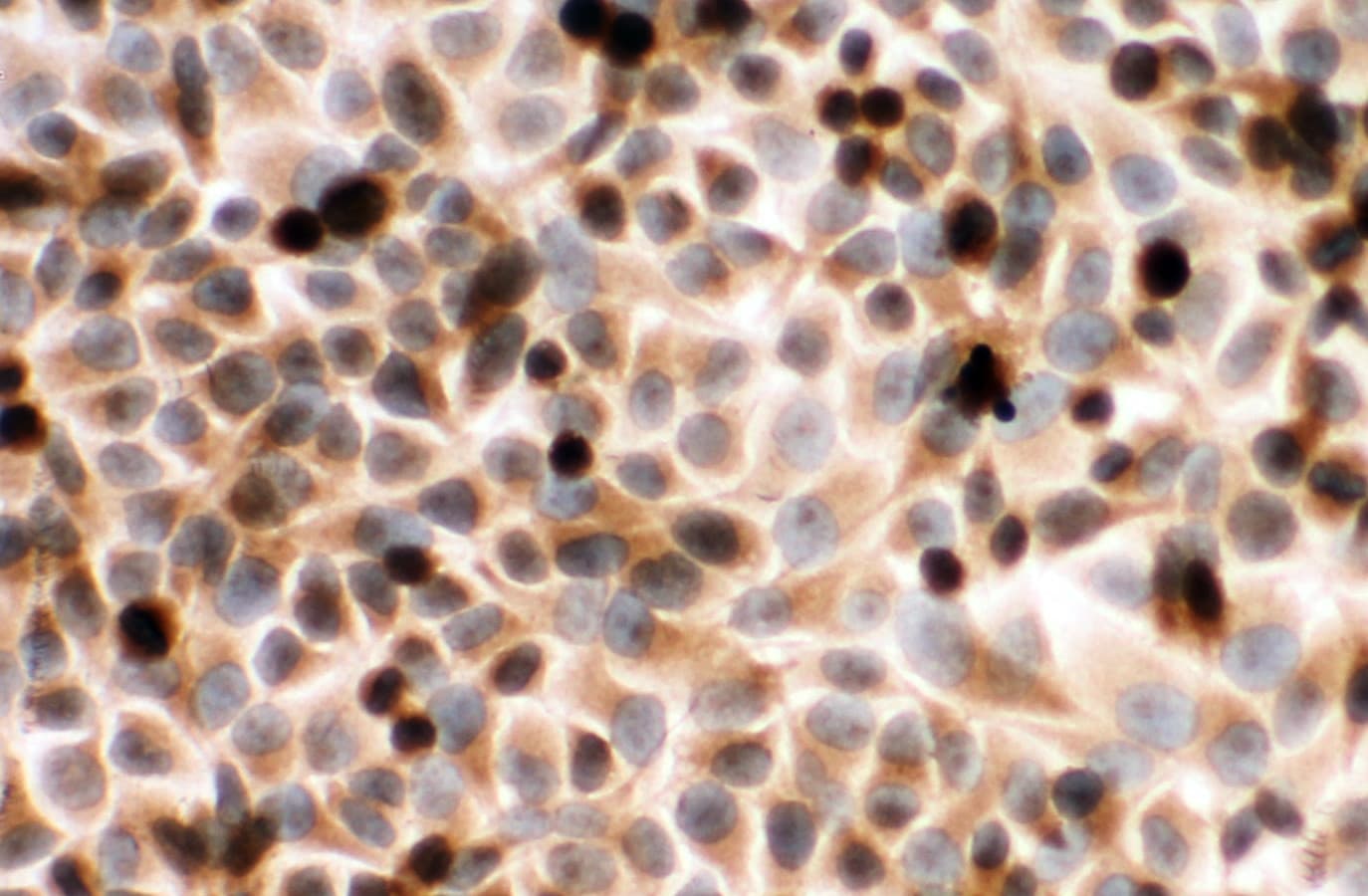 Polyclonal Rabbit anti-Human CYPOR / POR Antibody (aa659-677, IHC, WB)