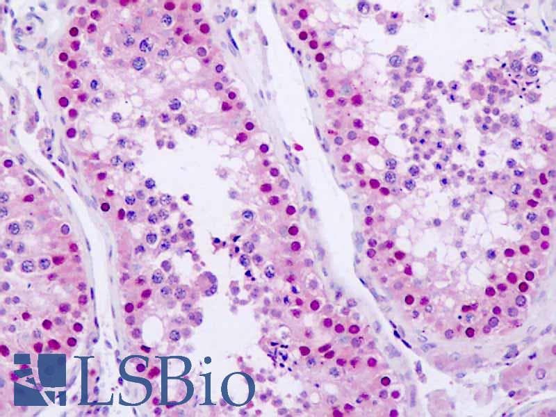 IHC-plus™ Polyclonal Rabbit anti-Human ANKRD30A / NY-BR-1 Antibody (aa1041-1090, IHC, WB)