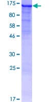 Human OAT Protein (Recombinant GST)